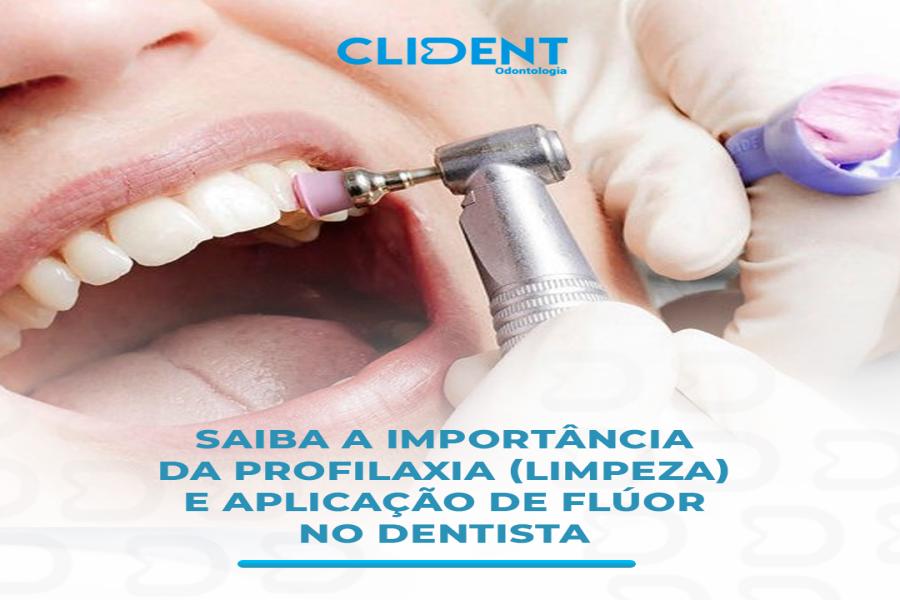 A importância da profilaxia (limpeza) e aplicação de flúor no dentista