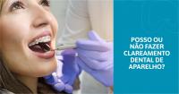 Posso ou não fazer clareamento dental usando aparelho?