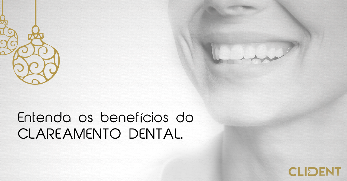 Entenda os benefícios do Clareamento Dental.